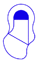 Oddyssey Right Curve